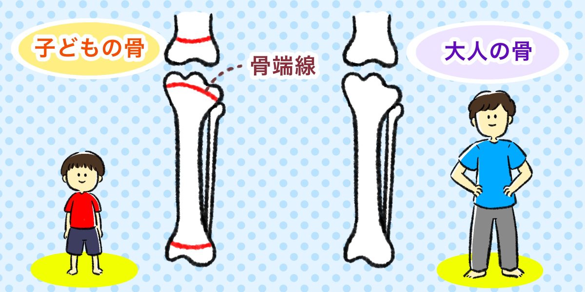 男の子の発育 背が伸びる 伸びないの分かれ道 骨端線 ってなあに Hugkum はぐくむ