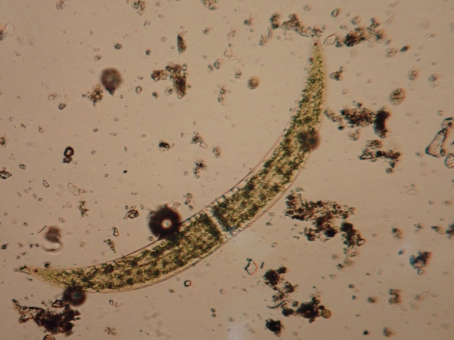 三日月形の1つの細胞のなかに青緑色にみえる葉緑体があるミカヅキモ