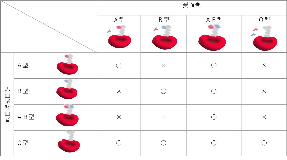 同じ血液型同士は基本的にOK。AB型はすべての血液型から血液を受けることができ、O型はすべての血液型に血液を提供することができる