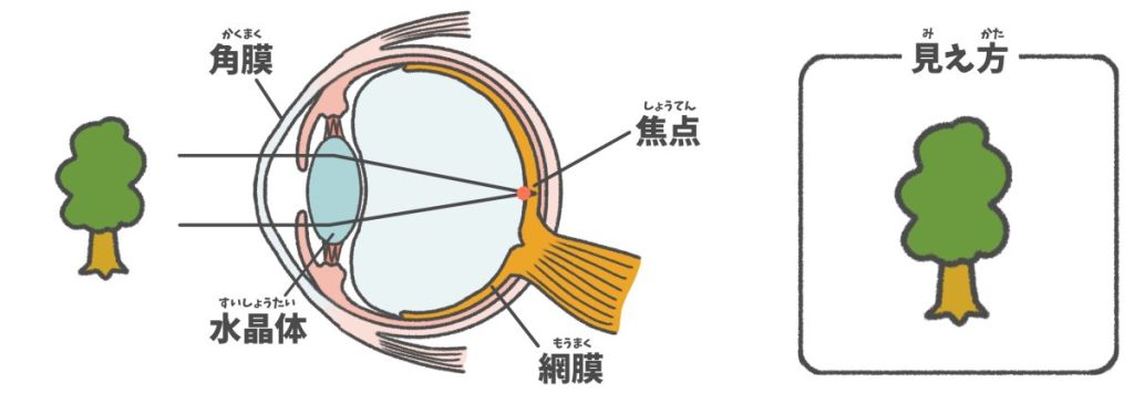 角膜と水晶体で屈折した光は、網膜で感知され、視神経から脳に伝わる。