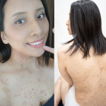 「ゾンビみたい」「何で生きてるの？」3000人に1人の難病を抱え、見た目を否定され続けてきた10年間。孤独な自分を支えたのは“たったひとつの夢”【ガラス作家・大河内愛美さん｜前編】